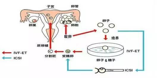 南宁是广西壮族自治区的首府，也是一个重要的区域医疗中心。南宁拥有先进的医疗设施和技术，在辅助生殖技术方面具有丰富的经验和专业知识。